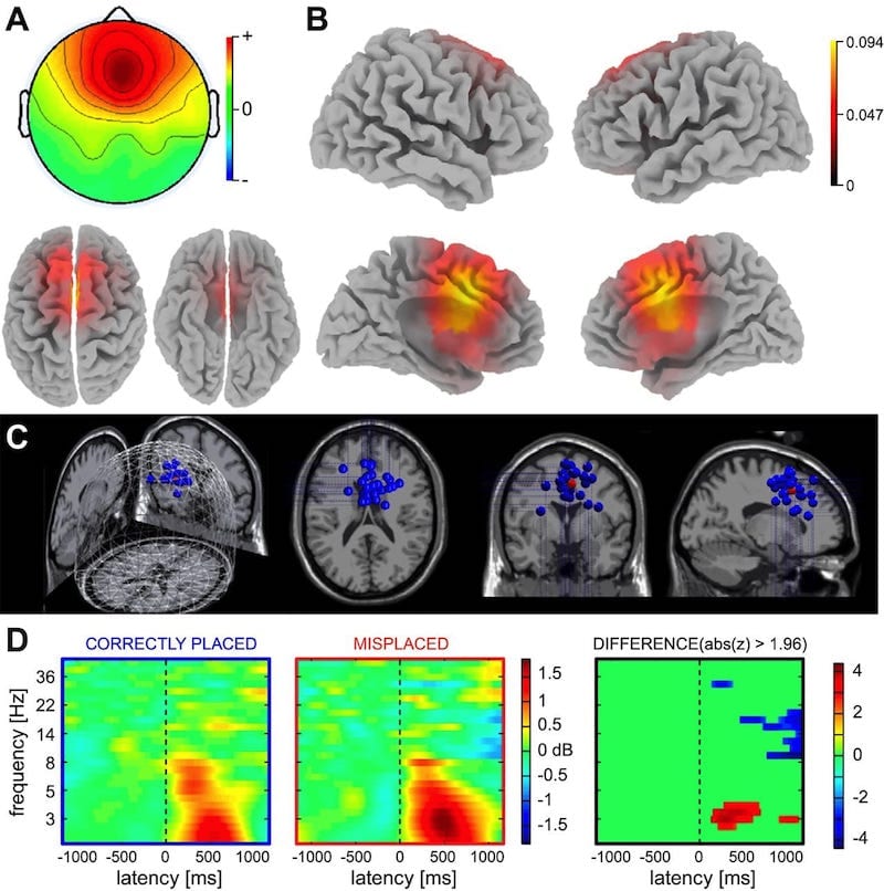 EEG/ECG Signal Intelligence Pipeline